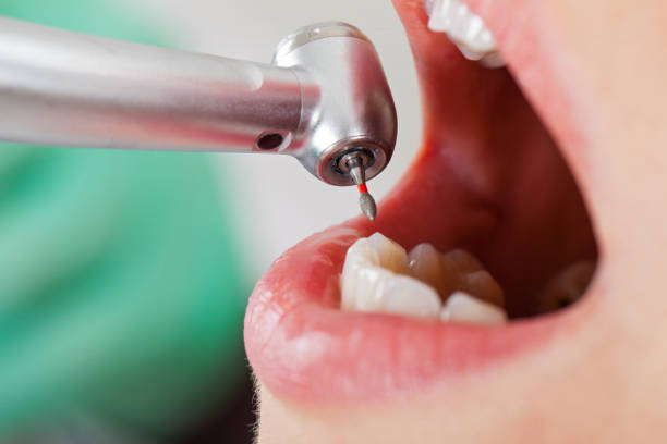 Dentist for Dental Trauma in CO